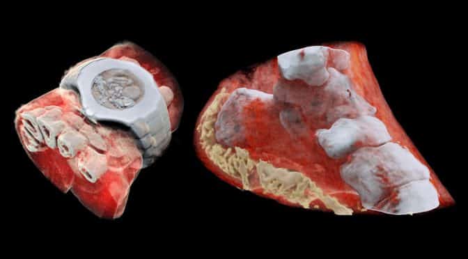 3D color x-ray images of the human body